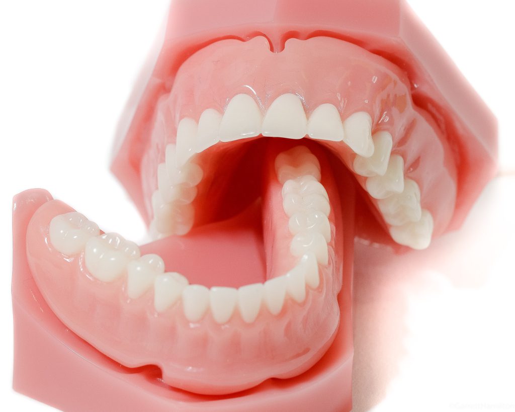 پروتز و روکش دندان